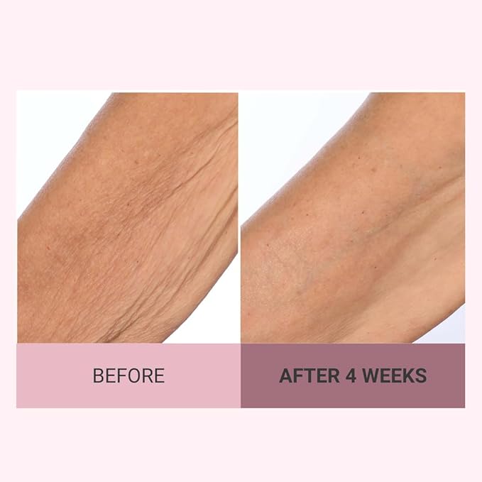 Consult Beaute Champagne Lift Hydrating Firming Body Cream with Pink Pepperslim for Crepey Skin Moisturizer Tightens, Tones & Hydrates Dry Skin on Arms & Legs - 8 oz.