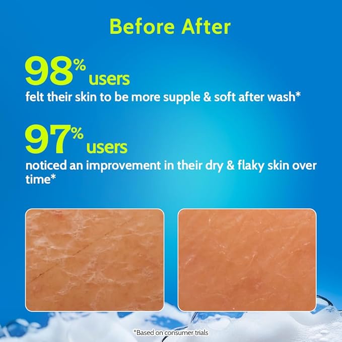 Chemist at Play Hydrating Body Wash |With 5% Hyaluronic Acid Bodywash for Intense Hydration | Reduces Flakes & Itchiness |For Dry Skin |Polyglutamic Acid & Hyaluronic Acid |For Women & Men | 7.9 Fl oz