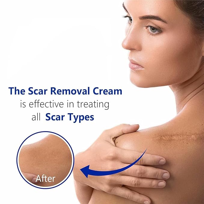 Advanced Scar Gel for Surgical Scars, Face, Body, Legs, Burns, Acne, C-Section, Stretch Marks, Keloids - Effective Scar Removal for Men and Women, Suitable for Old & New Scars (100% New -1 Bottle)