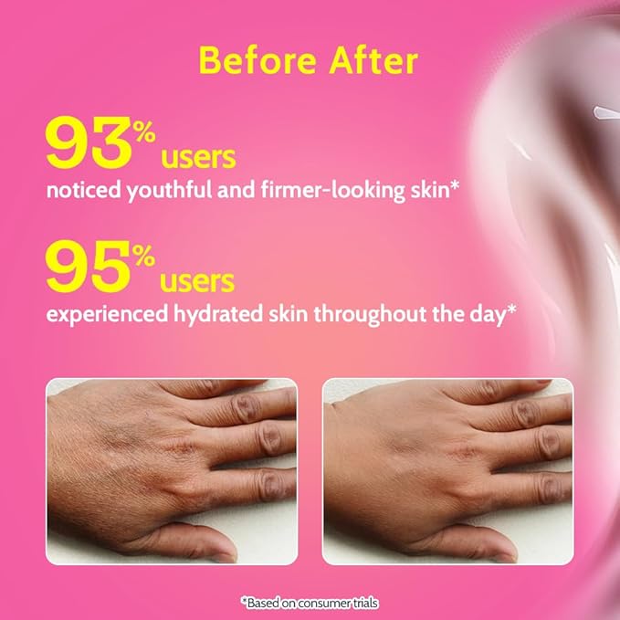 Chemist at Play Anti-Aging Body Lotion with 4% Retinol, Niacinamide & Zemea | Skin Brightening Lotion | Body Lotion for Dry & Oily Skin | Fights Visible Signs Of Aging | Nourshes Skin 7 fl oz.