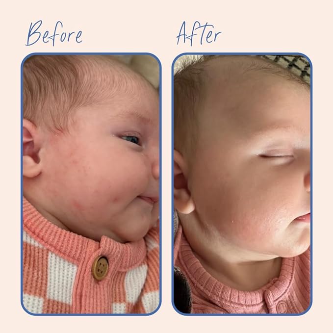 TUBBY TODD 3-Step Baby Bath & Skincare Routine - The Regulars Bundle - 8.5oz Baby Shampoo and Body Wash, 8.5oz Everyday Lotion & 3.5oz All Over Ointment - Lavender Rosemary