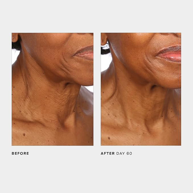 U Beauty The SCULPT Neck + Décolleté Concentrate