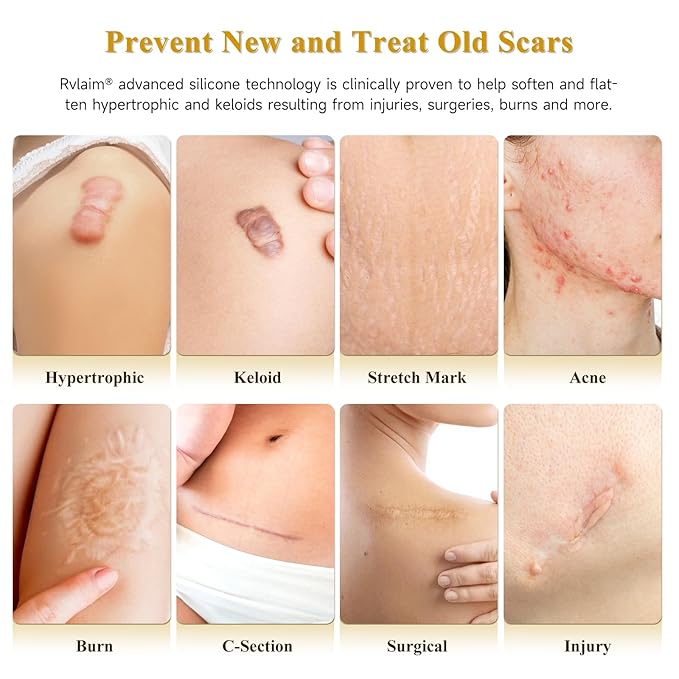 Silicone Scar Cream Scar Gel, Advanced Scar Cream for Surgical Scars, C-Section, Injury, Stretch Marks, Acne, Burns, Keloids, Old & New Scars, 1.85 Oz (55g)