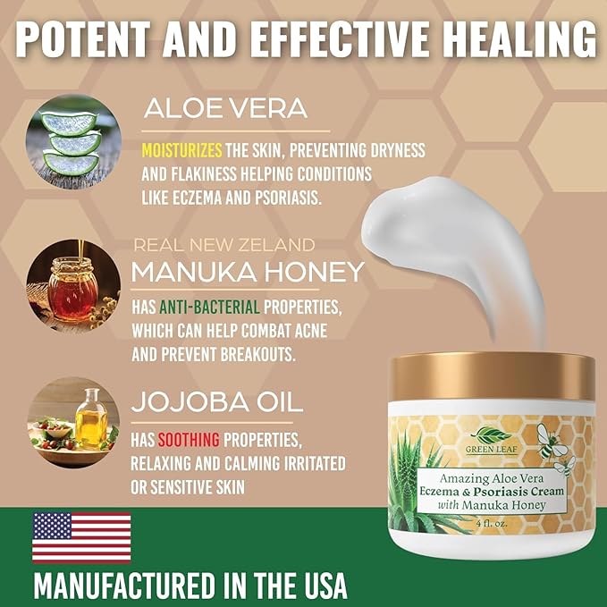Manuka Honey Eczema Cream Moisturizing Lotion for Psoriasis Relief - Itchy, Dry Skin Rash Ointment - Soothing Moisturizer for Baby, Kids, Adults - High Strength Body & Face Cream 4oz