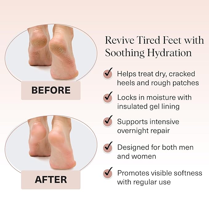 Kitsch Moisturizing Socks for Cracked Heel Treatment – Reusable Spa Socks for Women & Men with Insulated Gel Lining - Overnight Heel Socks for Dry Cracked Feet, Hydrating, Open-Toe Design - 1 Pair