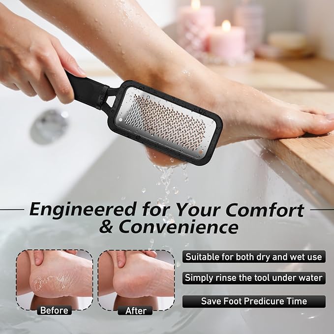 BALUCA Professional Foot File & Callus Remover - Stainless Steel Foot Rasp & Metal Feet Scrubber, Pedicure Tool for Hard Skin & Dead Skin Removal, Cracked Heel Repair for Baby Soft Feet (Black)