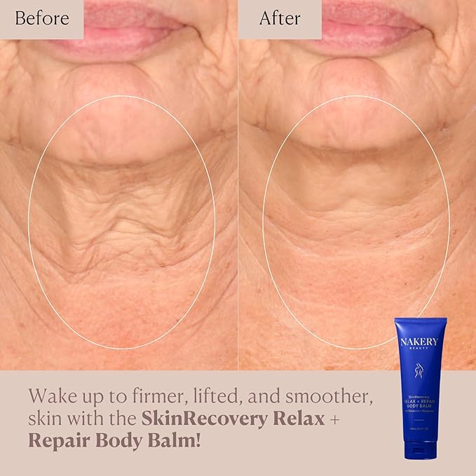 Nakery SkinRecovery Relaxing Magnesium Balm - Skin Tightening Cream for Body with SepiLift & Retinol - Muscle Balm with Melatonin for Restful Sleep - Hydrating Dry Skin Cream with Shea Butter