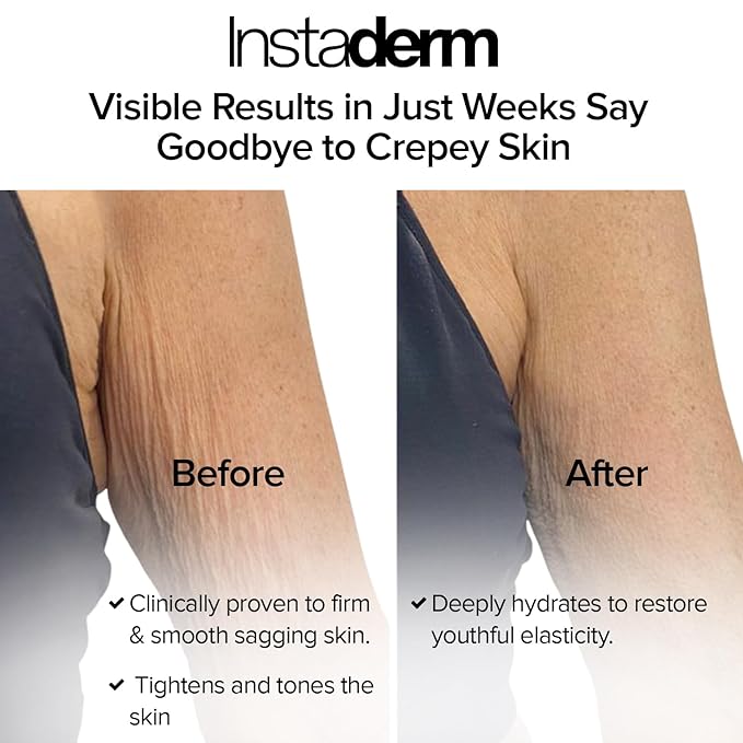 Crepe Fix Body Restorative Cream – Anti-Aging Wrinkle Cream, Support Skins Natural Elastin & Collagen Production to Restore, Lift, Tighten, Hydrate & Smooth Thinning Aged Crepey Skin. 4OZ