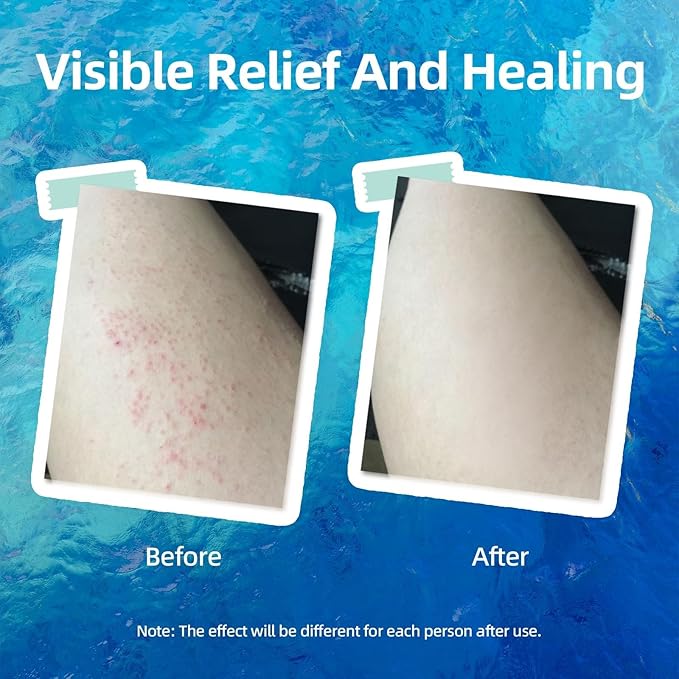 Crogooe Natural Soothing Eczema Cream With Sea Moss Aloe Vera Oats for Multiple Skin Types Comfort Moisture Hydrate Eczema Cream for Dry Skin 4FL Oz