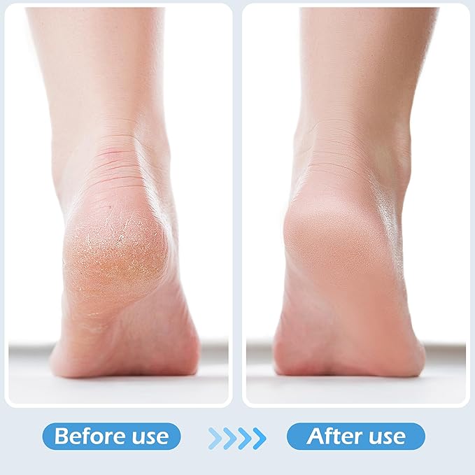 3 Pcs 4 in 1 Foot Brush for Use in Shower with Pumice Stone, Foot Rasp and Sandpaper, Foot Scrubber Brush for Feet, Dead Skin Remover for Foot Care