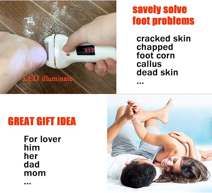 Electric Callus Remover for Feet, Long Service Time Foot Scrubber, Rechargeable Electronic Foot Files, Professional Pedicure Tools Pedicure Kit Feet Care for Crack Heel, Women Gift (White)