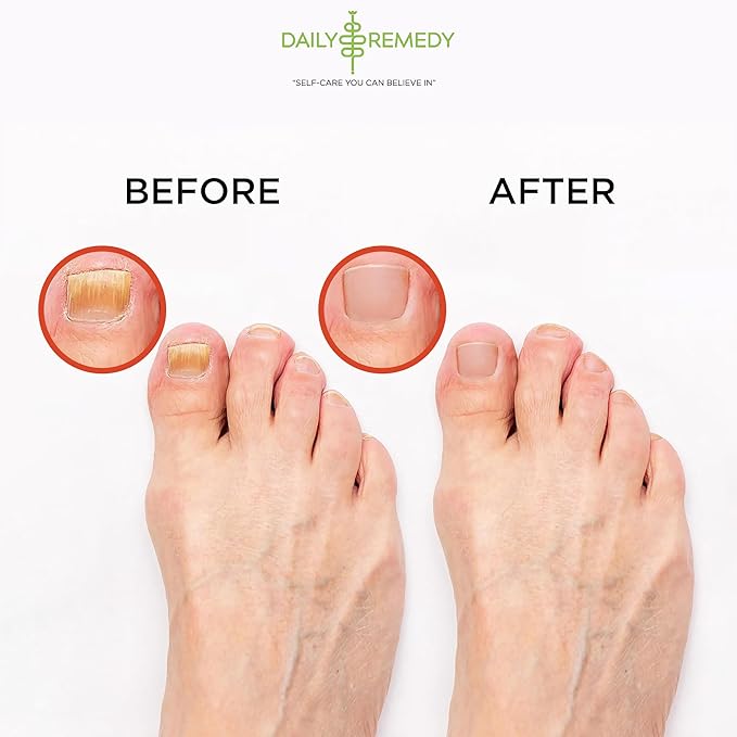Muscle Relief Foot Soak with Epsom Salt, Made in USA, Soothe Tired Feet, Softens Calluses and Helps Athletes Foot 1lbs