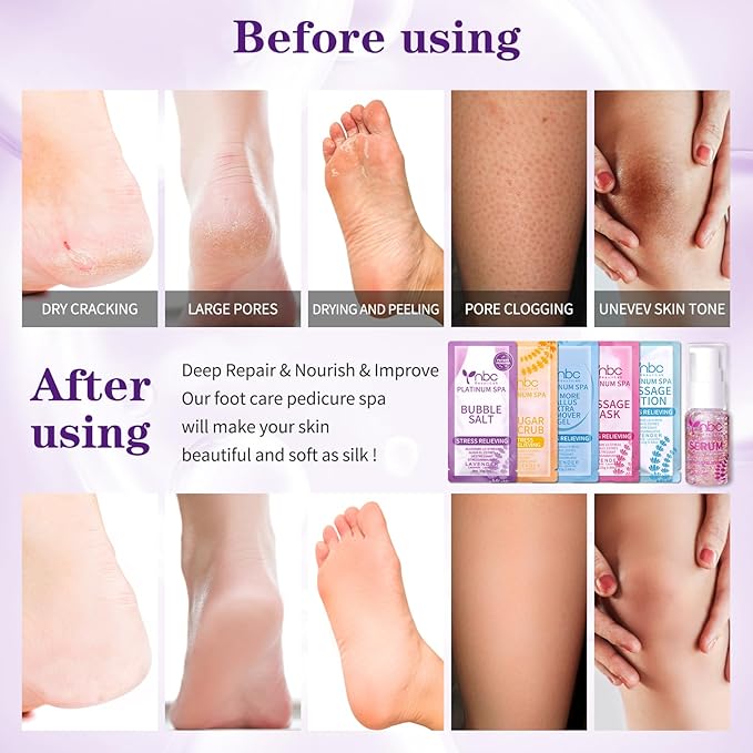 Pedicure Foot Soak Set - Upgraded 6 in 1 Foot Spa, Foot Bath Spa, Pedicure Kit for Tired & Dry Cracked Feet, Athletes Feet, Bad Odor, Softens Calluses (3 Set Lavender)