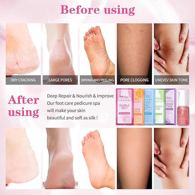 Pedicure Foot Soak Set - Upgraded 6 in 1 Foot Spa, Foot Bath Spa, Pedicure Kit, Foot Soak for Tired & Dry Cracked Feet, Athletes Feet, Bad Odor, Softens Calluses (Rose)