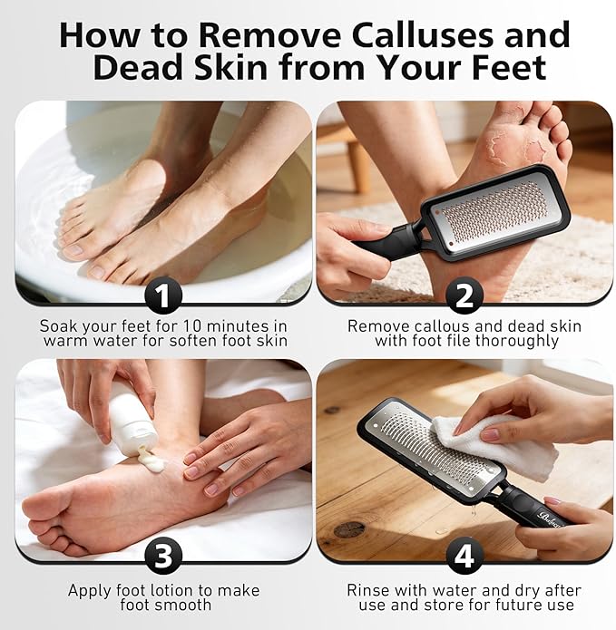 BALUCA Professional Foot File & Callus Remover - Stainless Steel Foot Rasp & Metal Feet Scrubber, Pedicure Tool for Hard Skin & Dead Skin Removal, Cracked Heel Repair for Baby Soft Feet (Black)