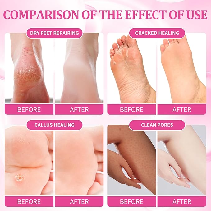 Pedicure Kit Foot Soak Set: Bubble Salt, Sugar Scrub, Massage Mask, Massage Lotion in a Box, 4 Step Foot Spa Kit for Dry Feet, Softens Calluses, Soothes Sore, Tired Feet（3 Set Rose)