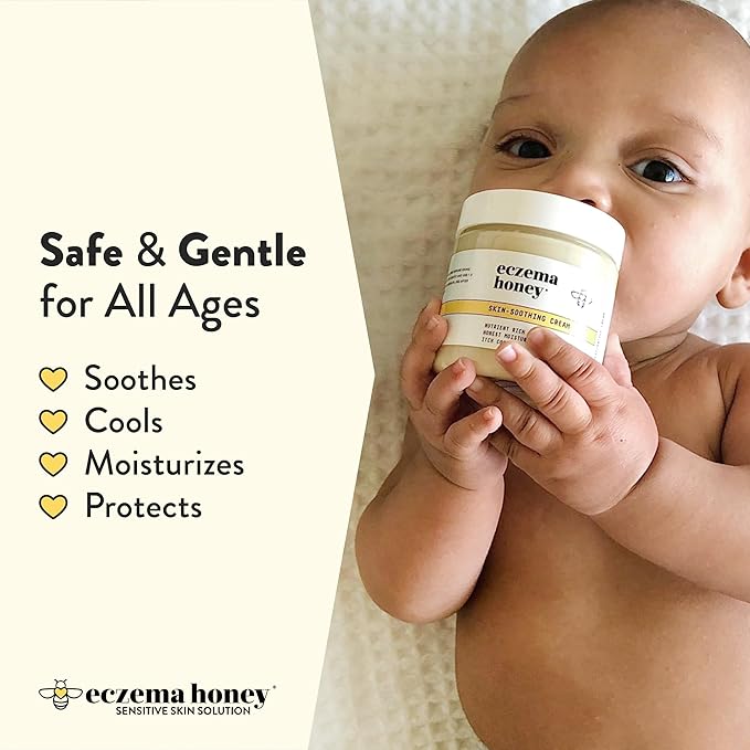 ECZEMA HONEY Original Skin-Soothing Cream - Organic Hand & Body Eczema Relief - Natural Honey Lotion for Dry, Itchy, & Irritable Skin (4 Oz)