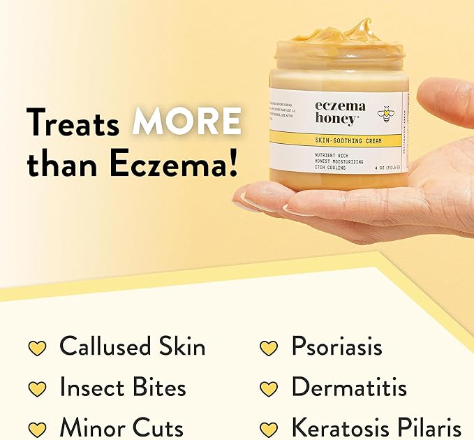 ECZEMA HONEY Original Skin-Soothing Cream - Organic Hand & Body Eczema Relief - Natural Honey Lotion for Dry, Itchy, & Irritable Skin (4 Oz)