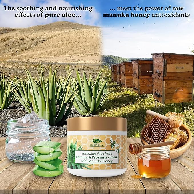 Manuka Honey Eczema Cream Moisturizing Lotion Treatment For Psoriasis Relief - Itchy, Dry Skin Rash Ointment -Skin Soothing Moisturizer Baby Kids & Adults -High Strength Body & Face Cream 8oz